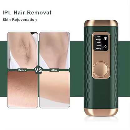 SEMINO Advanced Laser Hair Removal with Ice Cooling Technology(Green)