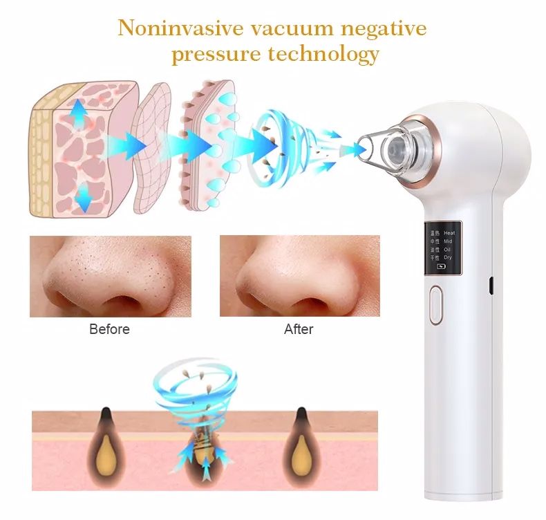 SEMINO Electric Blackhead Remover Vacuum With 5 Suction Heads & 3 Suction Level